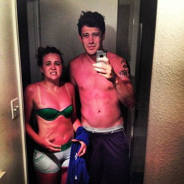 When Sunbathing Goes Wrong…