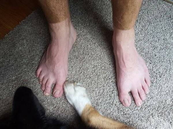 When Sunbathing Goes Wrong…