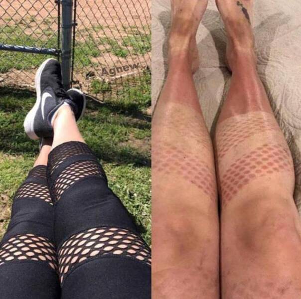 When Sunbathing Goes Wrong…