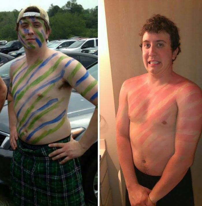 When Sunbathing Goes Wrong…