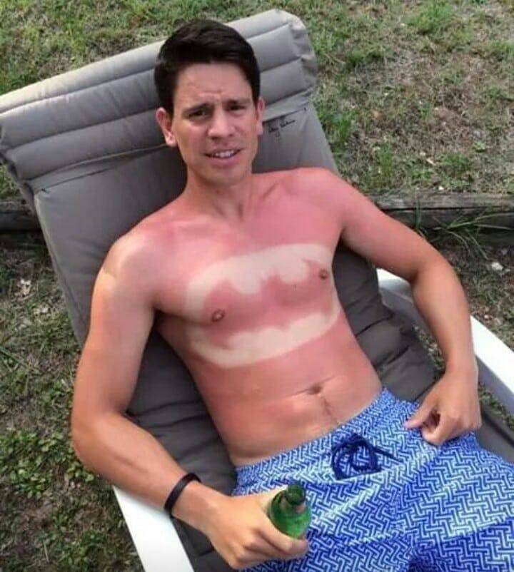When Sunbathing Goes Wrong…