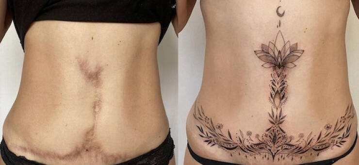 People Covering Their Scars In Cool Fashion