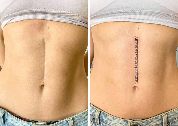 People Covering Their Scars In Cool Fashion