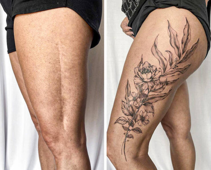 People Covering Their Scars In Cool Fashion