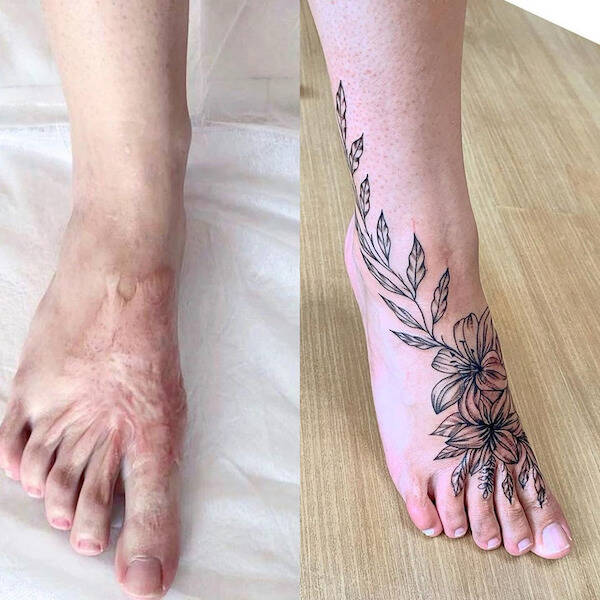 People Covering Their Scars In Cool Fashion