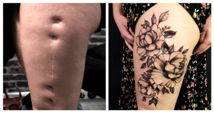 People Covering Their Scars In Cool Fashion