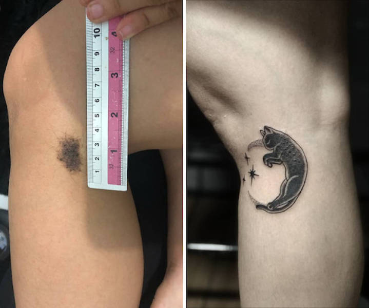 Tattoo Artists Covering Scars And Birthmarks