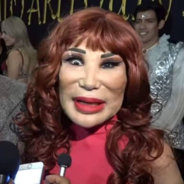 When Plastic Surgery Goes Too Far
