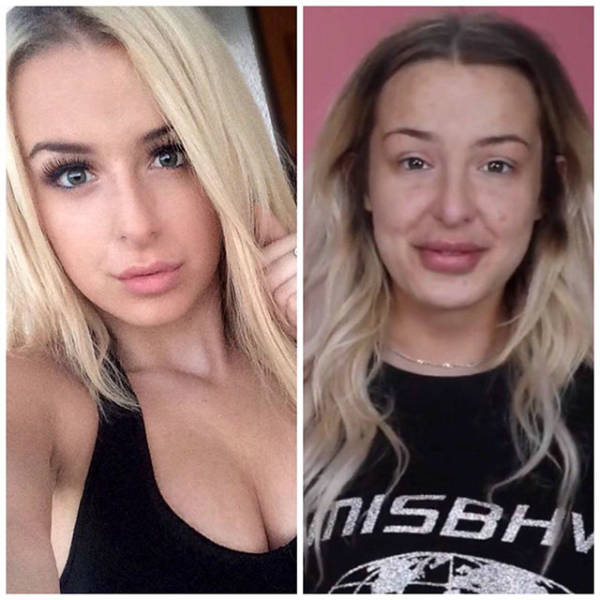 When Plastic Surgery Goes Too Far