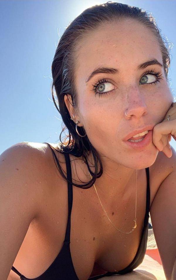 the charm of freckled faces 33 pics 12.html - 33 HD Photos | Premium Gallery 2023