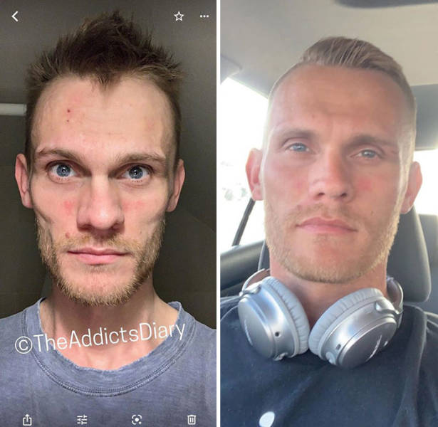 How Drug Addiction Looks Before And After