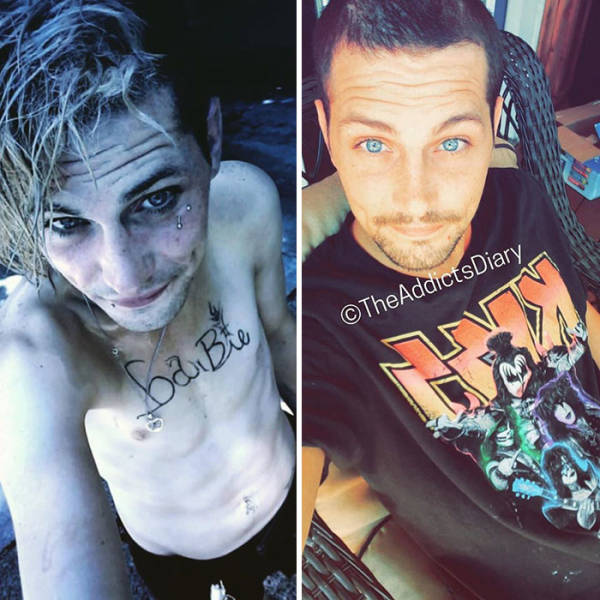 How Drug Addiction Looks Before And After