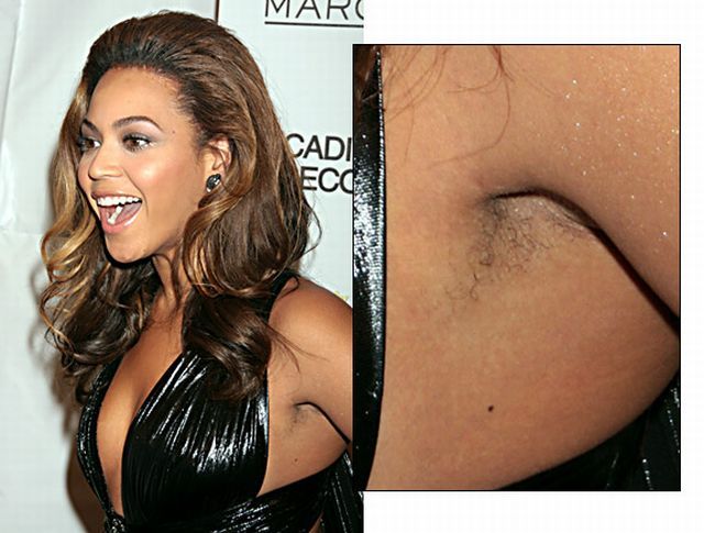 Hairy celebrities (15 pics)