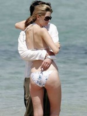 Celebrities and Their Imperfections! (58 pics)