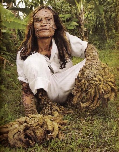 Have You Ever Seen a Tree Man? (19 pics)