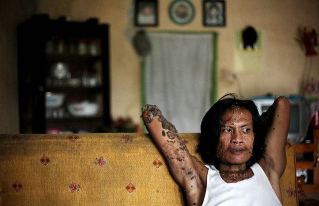 Have You Ever Seen a Tree Man? (19 pics)