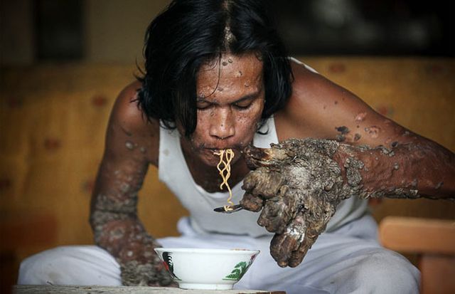Have You Ever Seen a Tree Man? (19 pics)