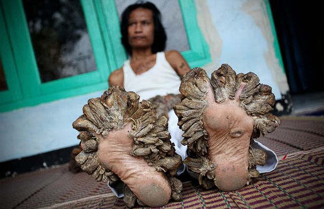 Have You Ever Seen a Tree Man? (19 pics)