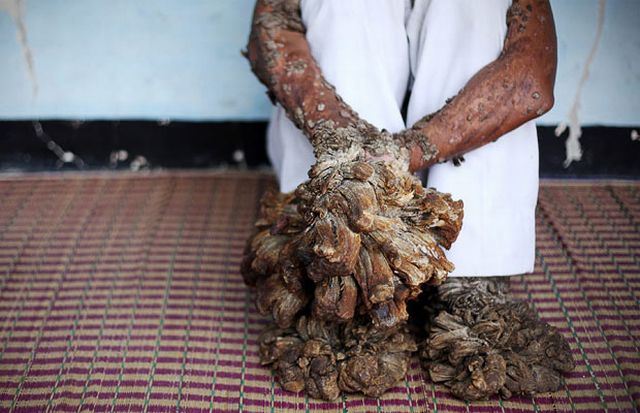 Have You Ever Seen a Tree Man? (19 pics)