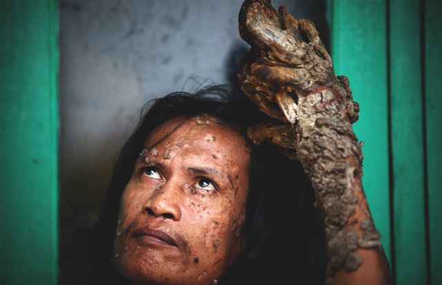 Have You Ever Seen a Tree Man? (19 pics)