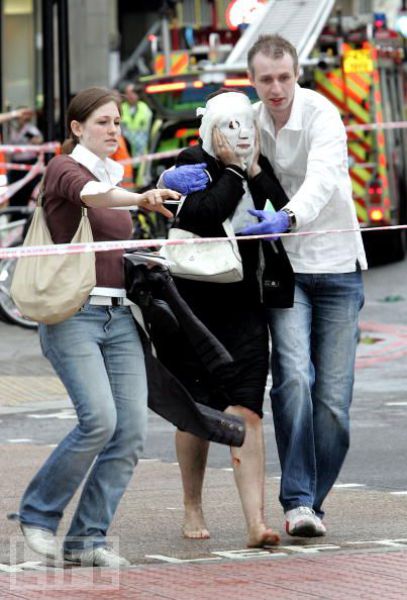 Incredible Healing after a Bomb Explosion (15 pics) Incredible Healing after a Bomb Explosion (15 pics)