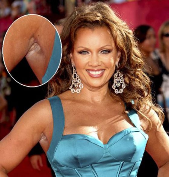 Celebrities Aren’t Perfect (31 pics) Celebrities Aren’t Perfect (31 pics)