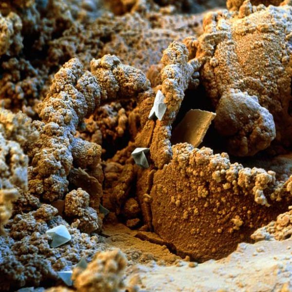 Amazing Scanning Electron Microscope Pictures