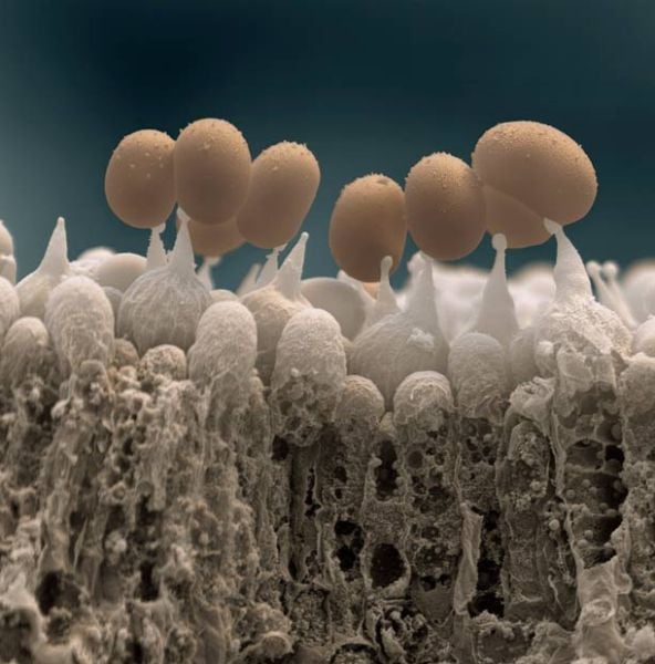 Amazing Scanning Electron Microscope Pictures