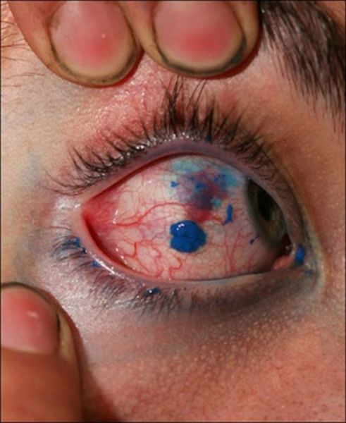 Horrible Self-made Tattoos