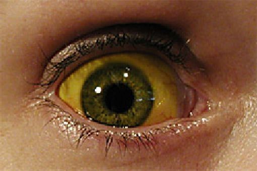 Eerie Eyeball Covers