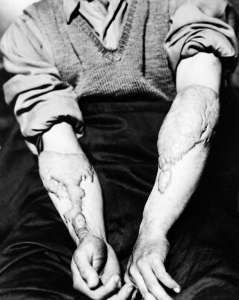 Frightening Hiroshima and Nagasaki Atomic Bomb Pictures