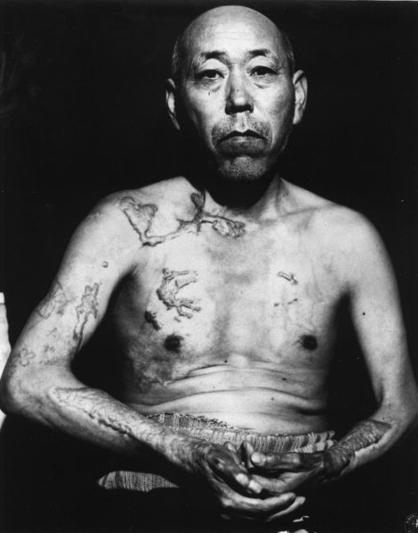 Frightening Hiroshima and Nagasaki Atomic Bomb Pictures