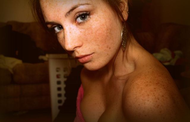 Freckles to the Front Please
