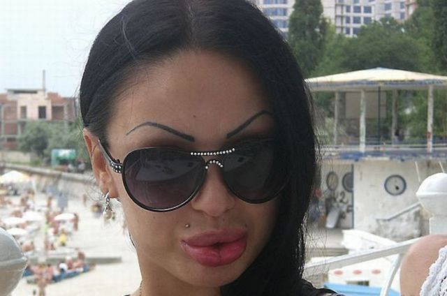 Sometimes Beauty Treatments Just Make You Ugly