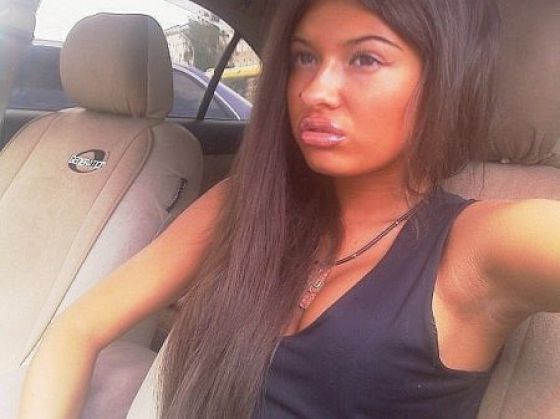 Sometimes Beauty Treatments Just Make You Ugly