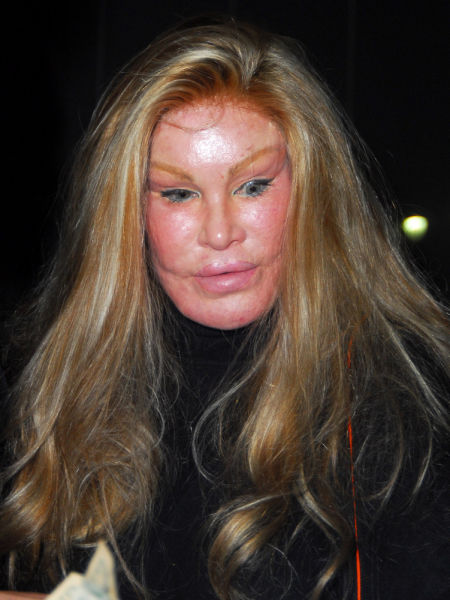 Sometimes Beauty Treatments Just Make You Ugly
