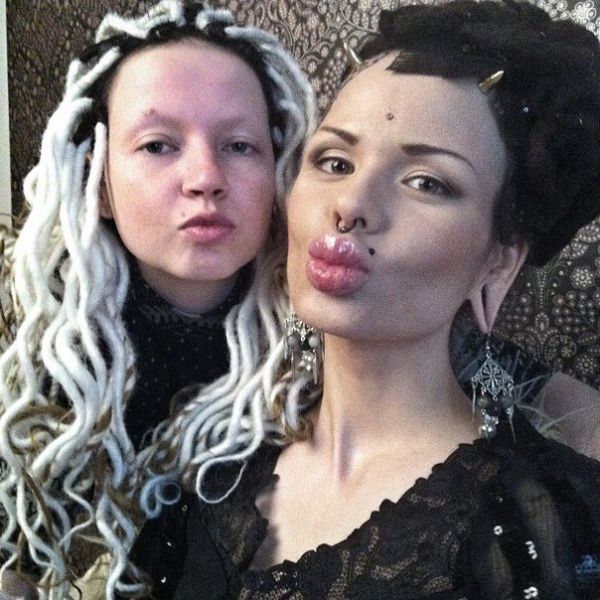 New Photos of the Girl with the World’s Largest Lips