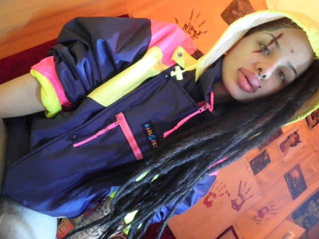 New Photos of the Girl with the World’s Largest Lips