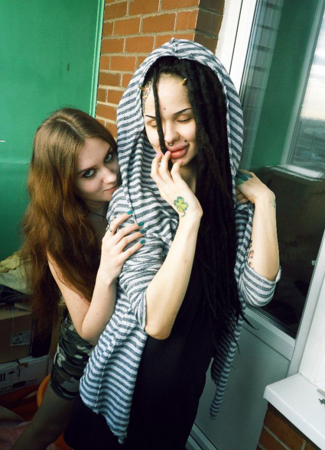 New Photos of the Girl with the World’s Largest Lips