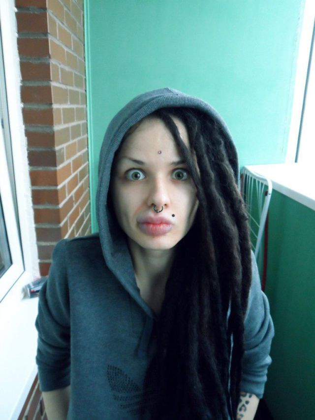 New Photos of the Girl with the World’s Largest Lips