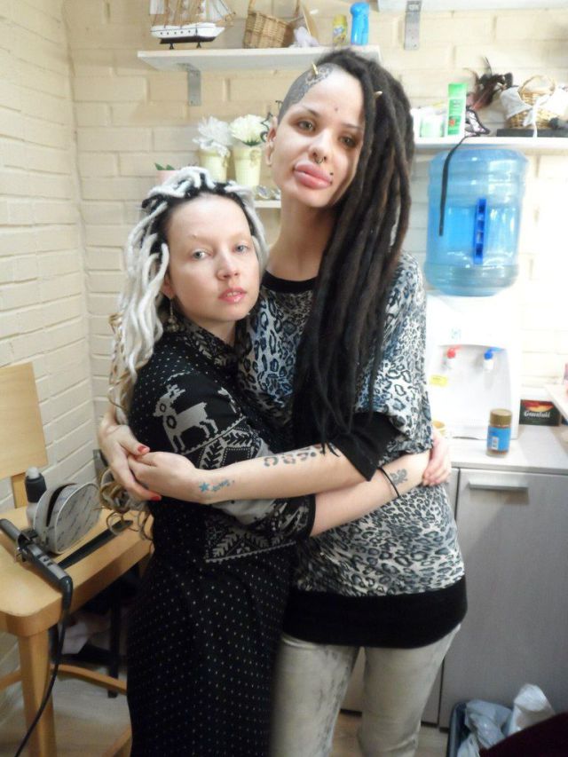 New Photos of the Girl with the World’s Largest Lips