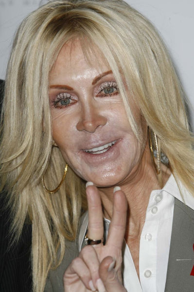 Plastic Surgery Fails That Are Just Wrong