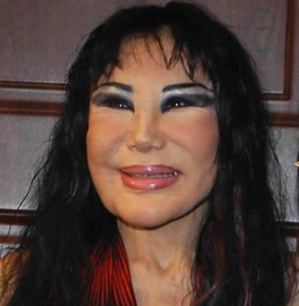 Plastic Surgery Fails That Are Just Wrong