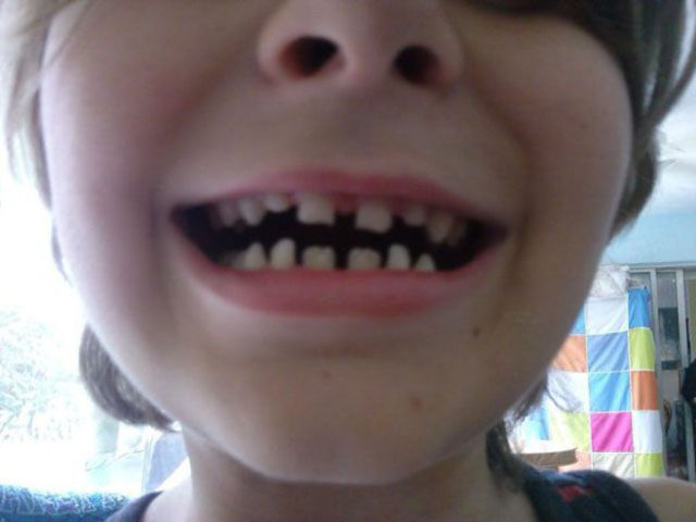 Just Wait Until You See It…