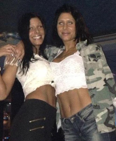 The Twins Who Have Had Identical Plastic Surgery